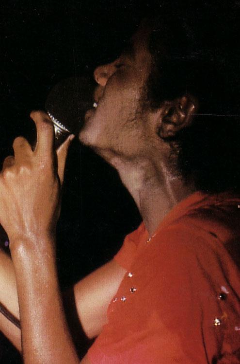 michael_vitiligo_21.jpg