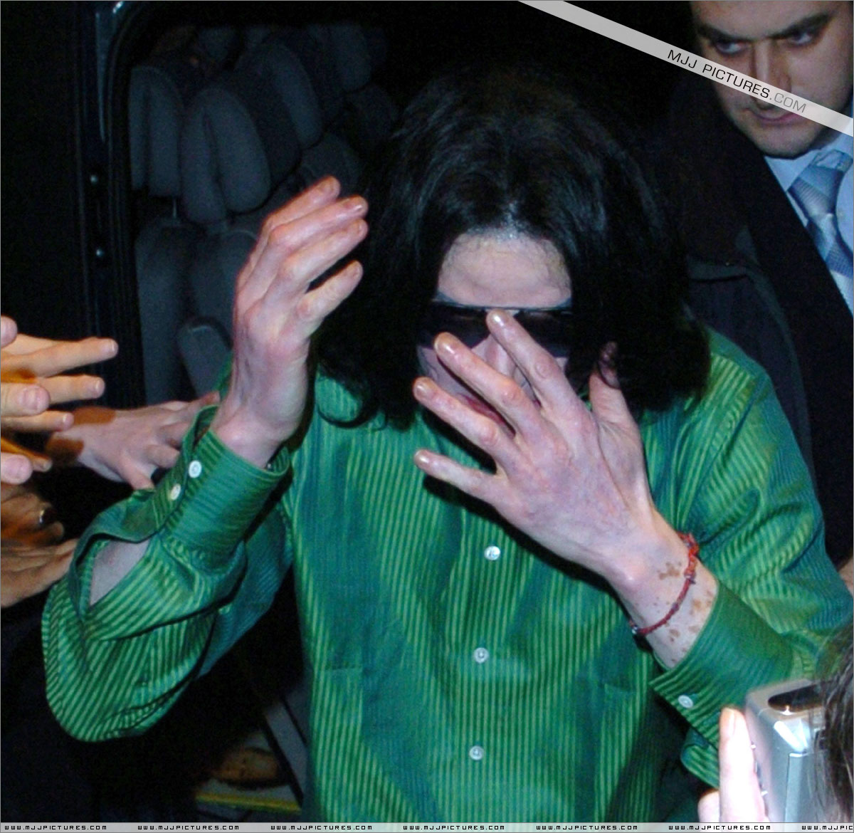 vitiligo_london05.jpg