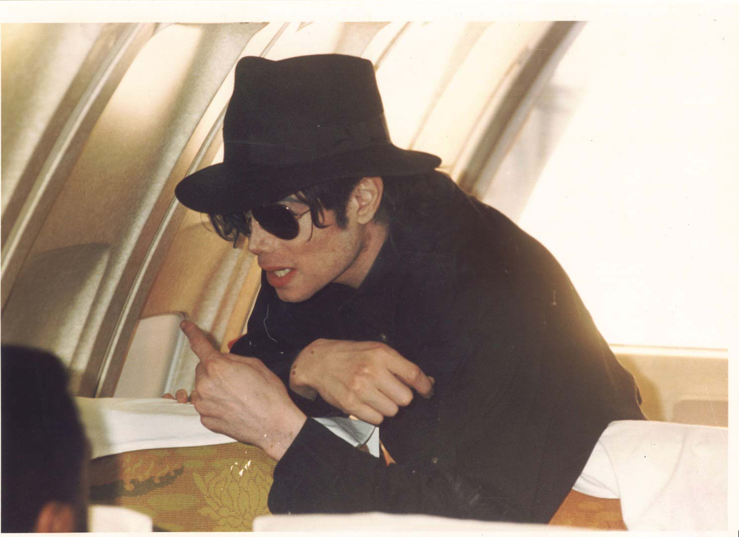 vitiligo.jpg