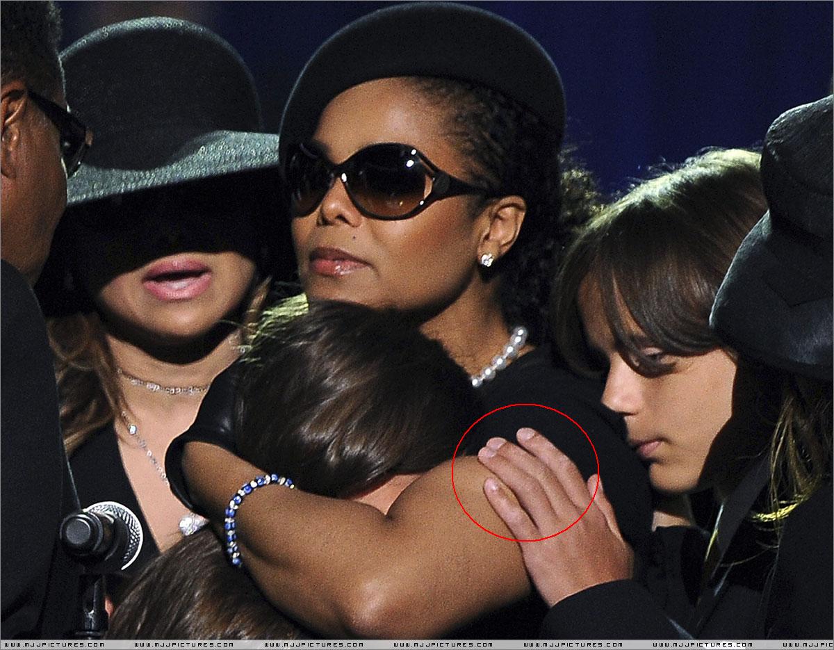 prince-michael-jr-vitiligo-04.jpg
