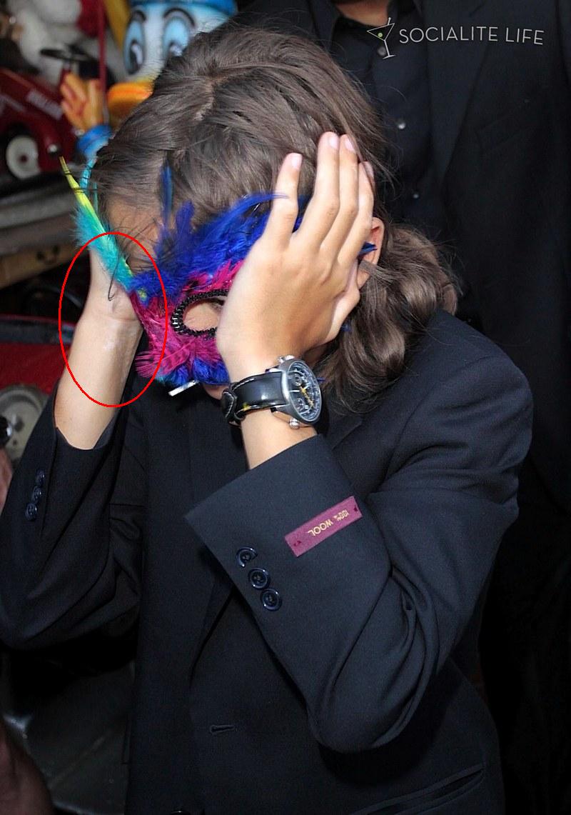 prince-michael-jr-vitiligo-01.jpg